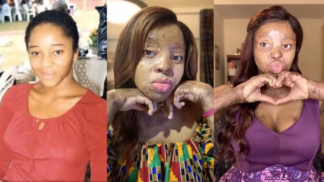 Inspiring stroy of Kechi Okwuchi; a Nigerian-American singer, survivor of fatal plane crash who went on to graduate with first degree in Economics