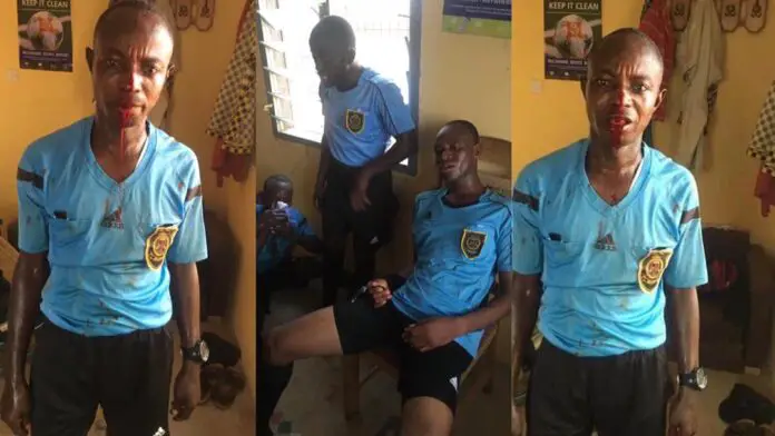 Referee loses all his teeth after match officials officiating Ghanaian Division 1 league were severely beaten by fans [Video]