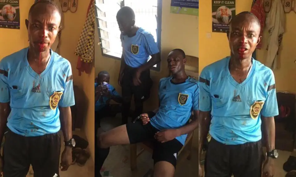 Referee loses all his teeth after match officials officiating Ghanaian Division 1 league were severely beaten by fans [Video]