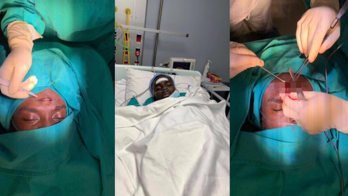 Blogger Ronnie undergoes surgery in South Africa to remove age-long protruding lump on his forehead