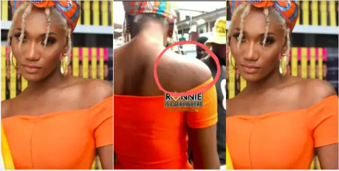 Fans drag Wendy Shay over her stretch marks