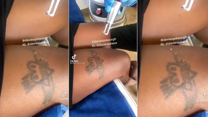 Slay queening is over: Lady painfully removes tattoo on her thighs after she was reportedly denied entry into the security services